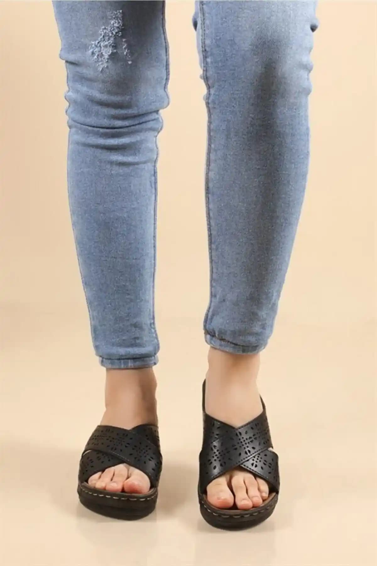 Apella Dolgu Topuk Ortapedik Bayan Terliği: Şıklık ve Konforun Birleşimi